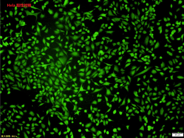 活性氧检测yabo官网手机版
盒